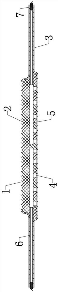 Preparation method of degradable wound dressing and batching equipment for the dressing