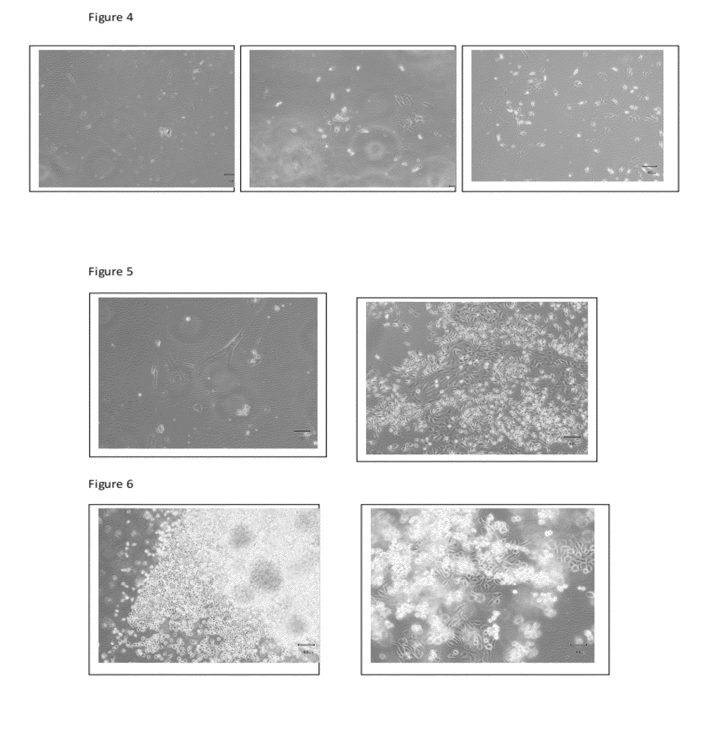 Compositions and methods for mobilization of stem cells