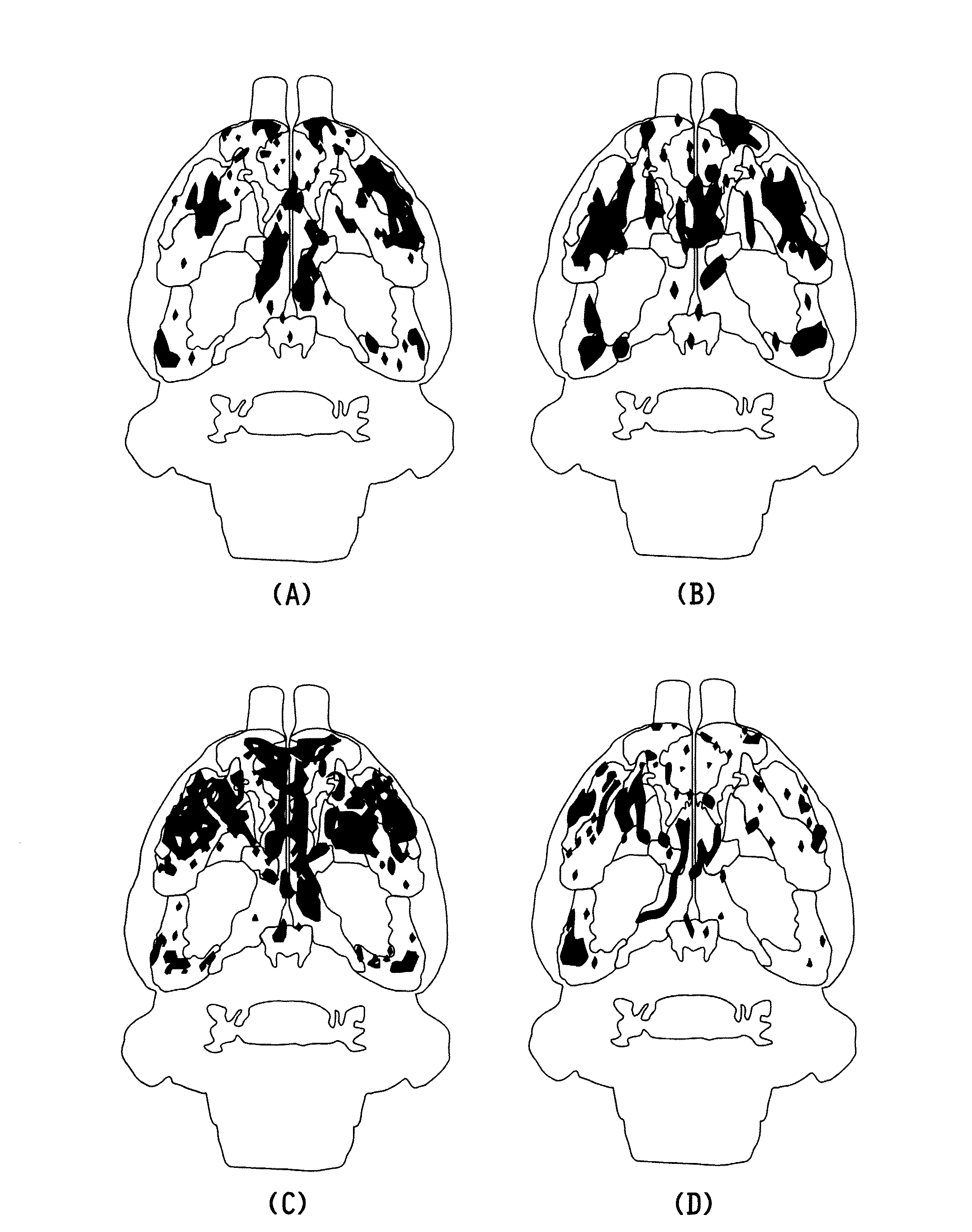 Methods for treating post traumatic stress disorder