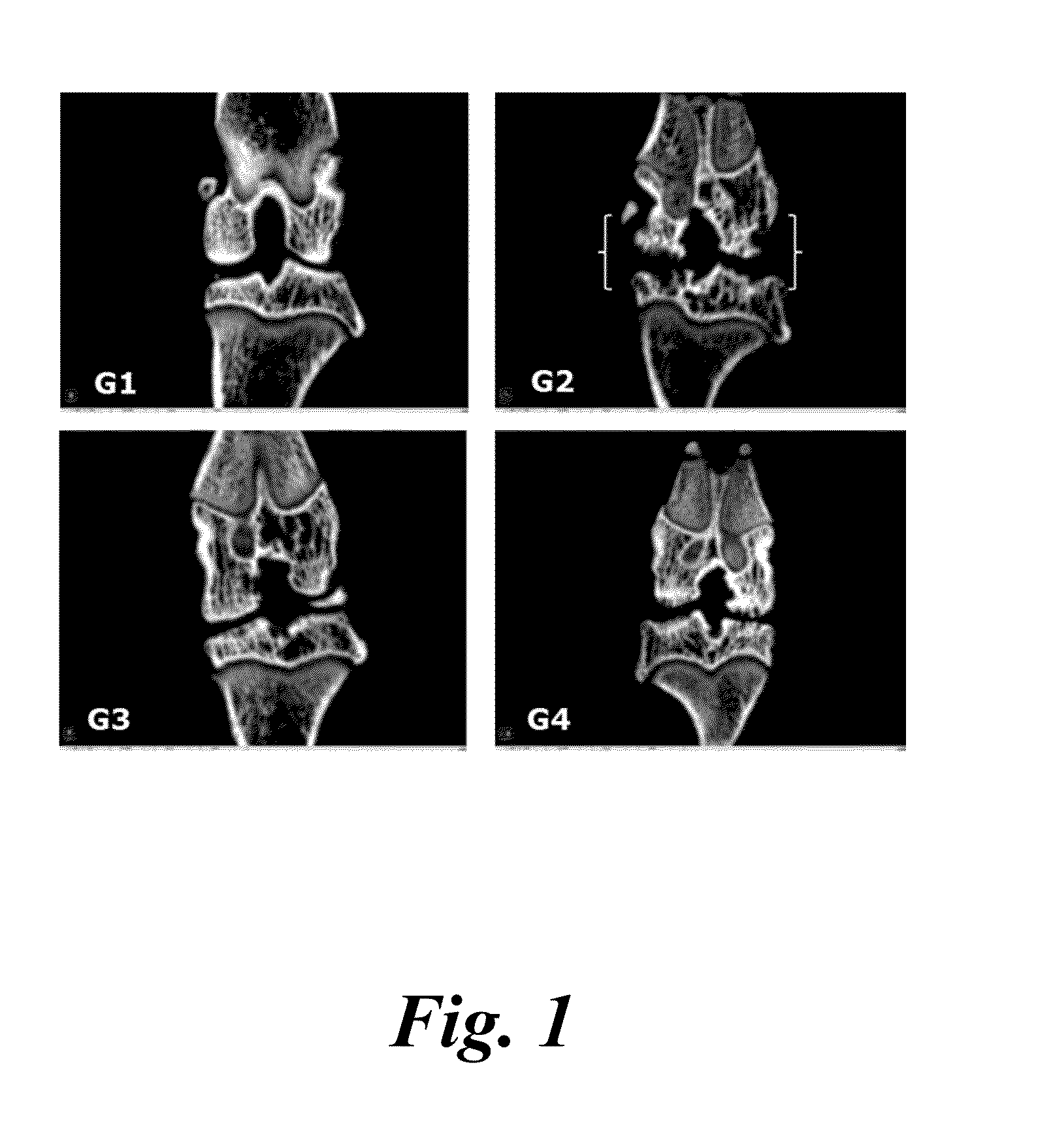 Compositions and methods for managing or improving bone disorders, cartilage disorders, or both