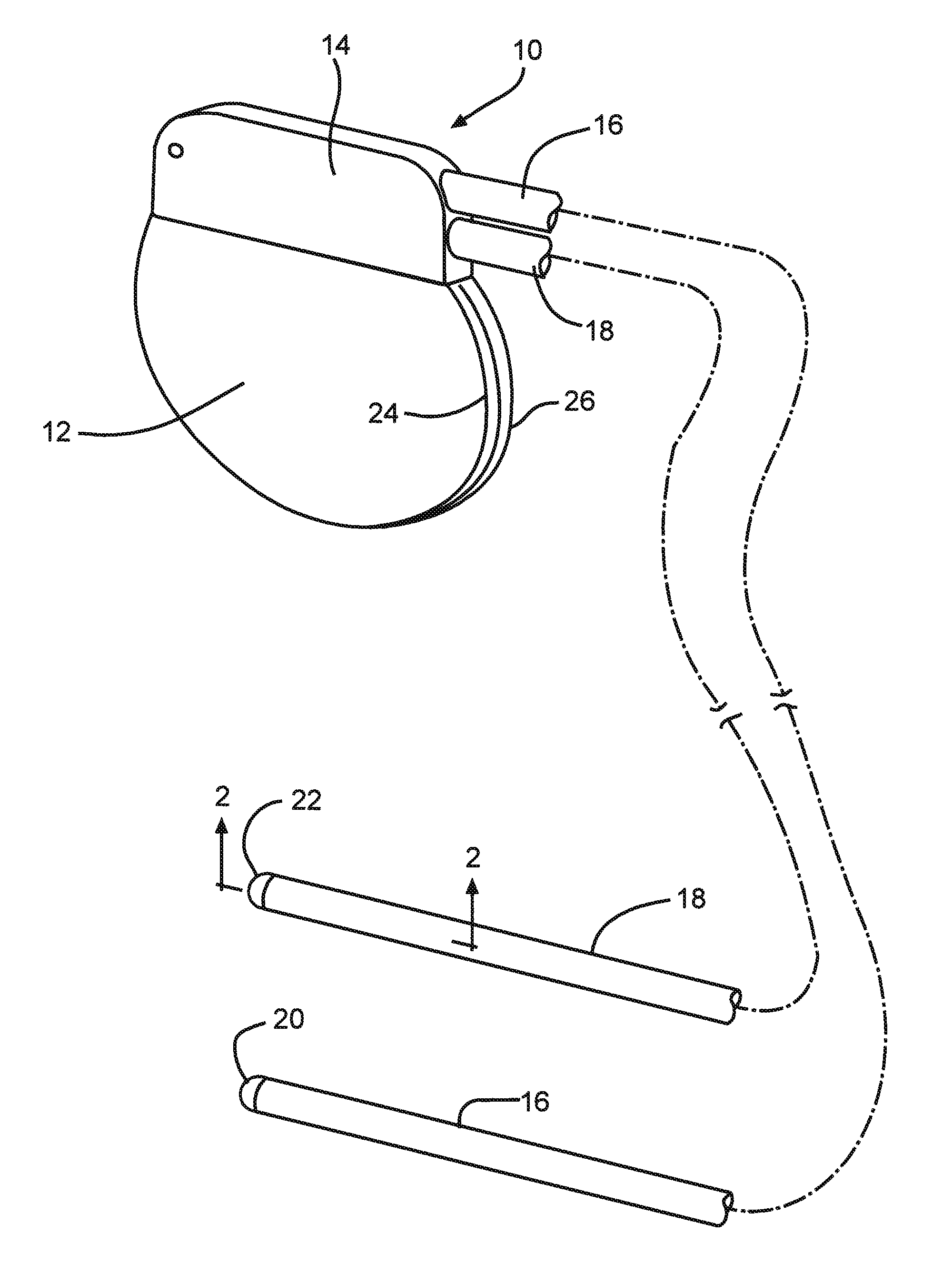 Method For Providing An Implantable Electrical Lead Wire