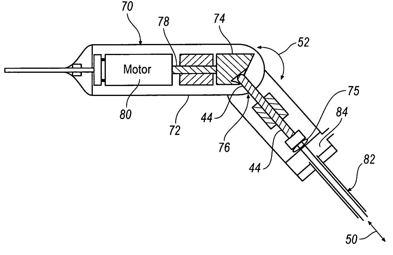 Adjustable surgical cutting instrument and cam system for use in same