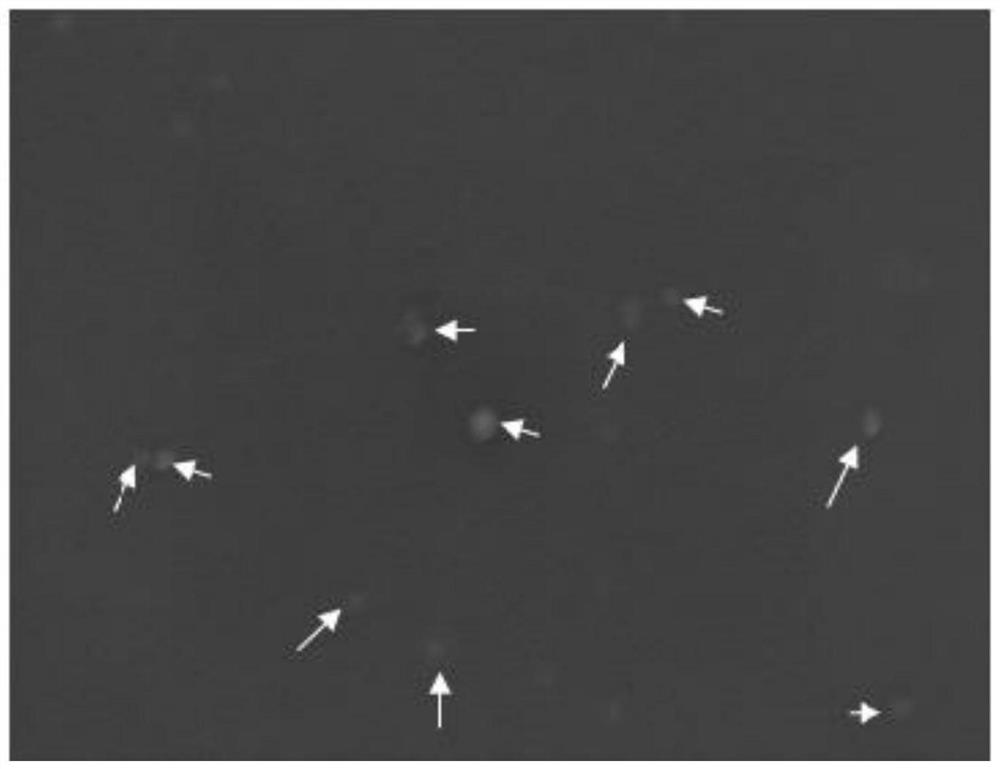 Application of Enzyme Immobilization Matrix in the Field of Biological Detection of Organophosphorus Pesticides
