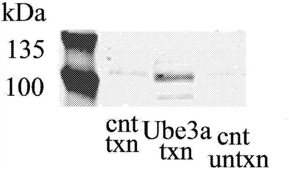 Modified UBE3A gene for a gene therapy approach for angelman syndrome