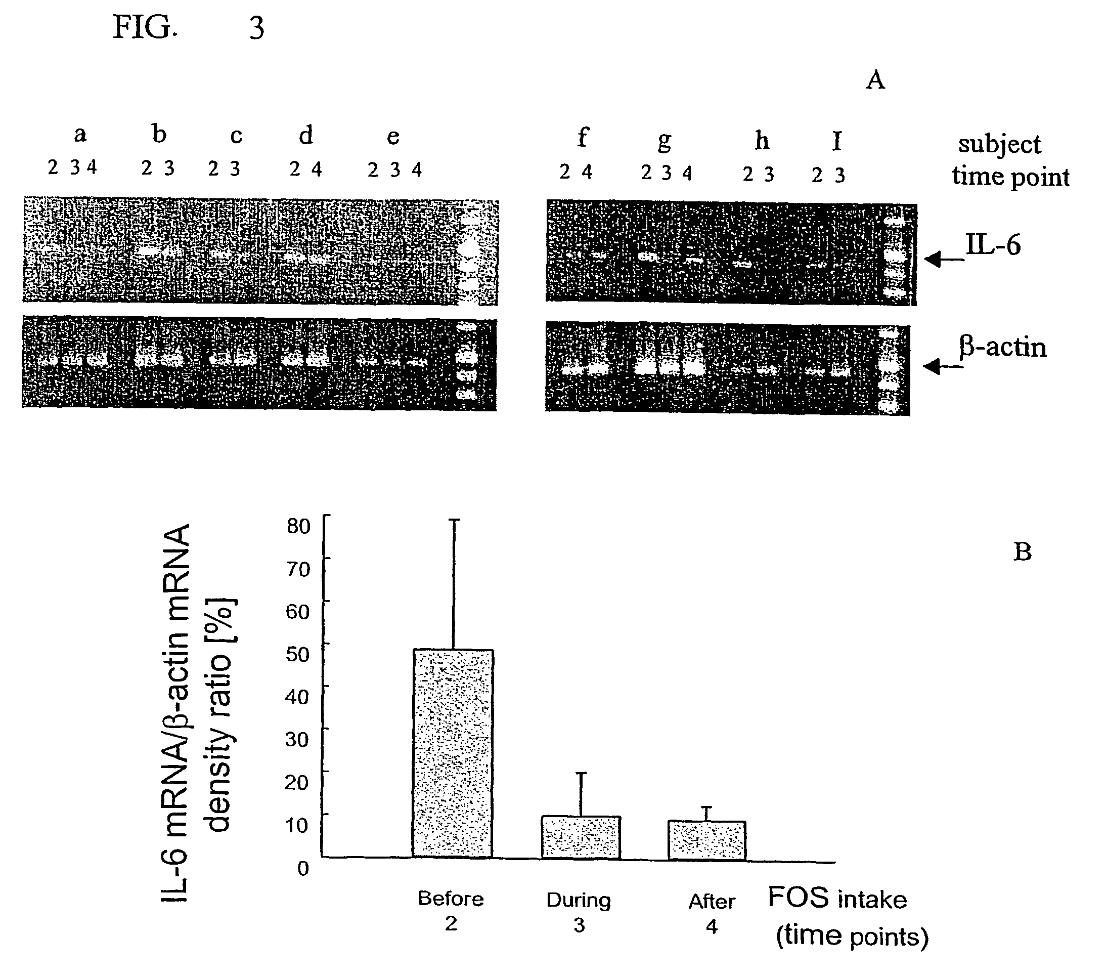 Composition comprising a prebiotic for decreasing inflammatory process and abnormal activation of non-specific immune parameters