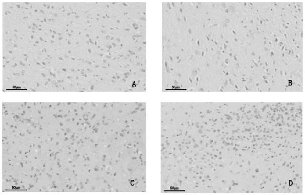 Composition and application for alleviating degenerative neuropathy