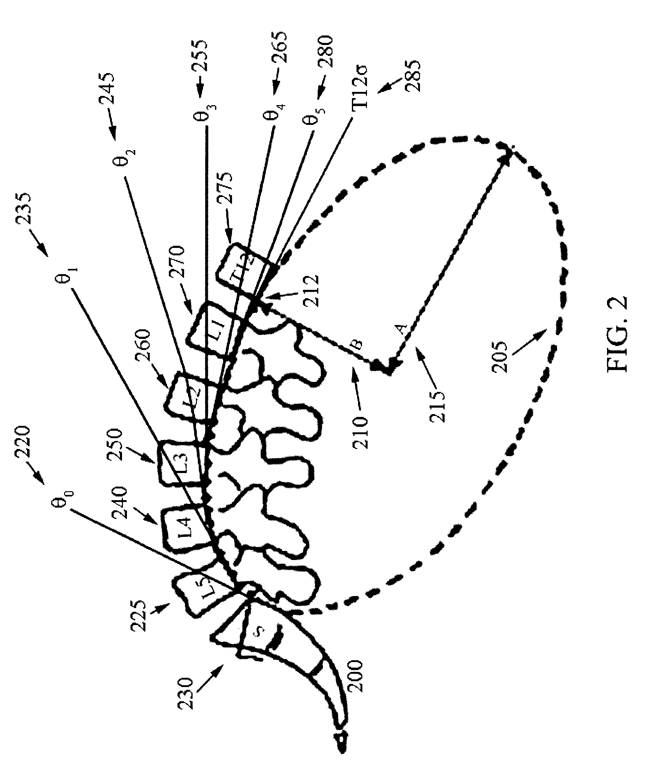 System for dynamically adjusting treatment angle under tension to accommodate variations in spinal morphology