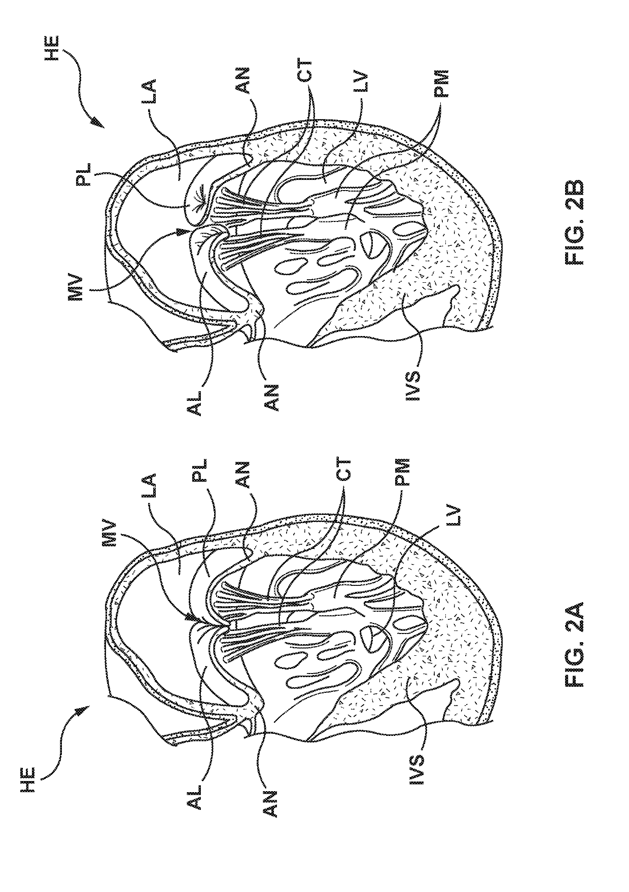 Flexible canopy valve repair systems and methods of use