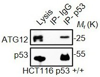 An application of promoting atg5-atg12 conjugation to enhance autophagy by scavenging wild-type p53 protein