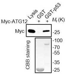 An application of promoting atg5-atg12 conjugation to enhance autophagy by scavenging wild-type p53 protein