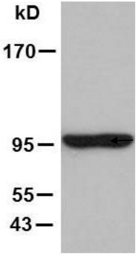 Application of heat shock protein gp96 to treatment of systemic lupus erythematosus