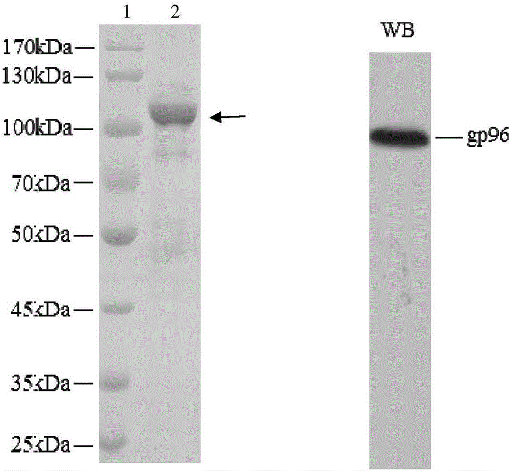 Application of heat shock protein gp96 to treatment of systemic lupus erythematosus