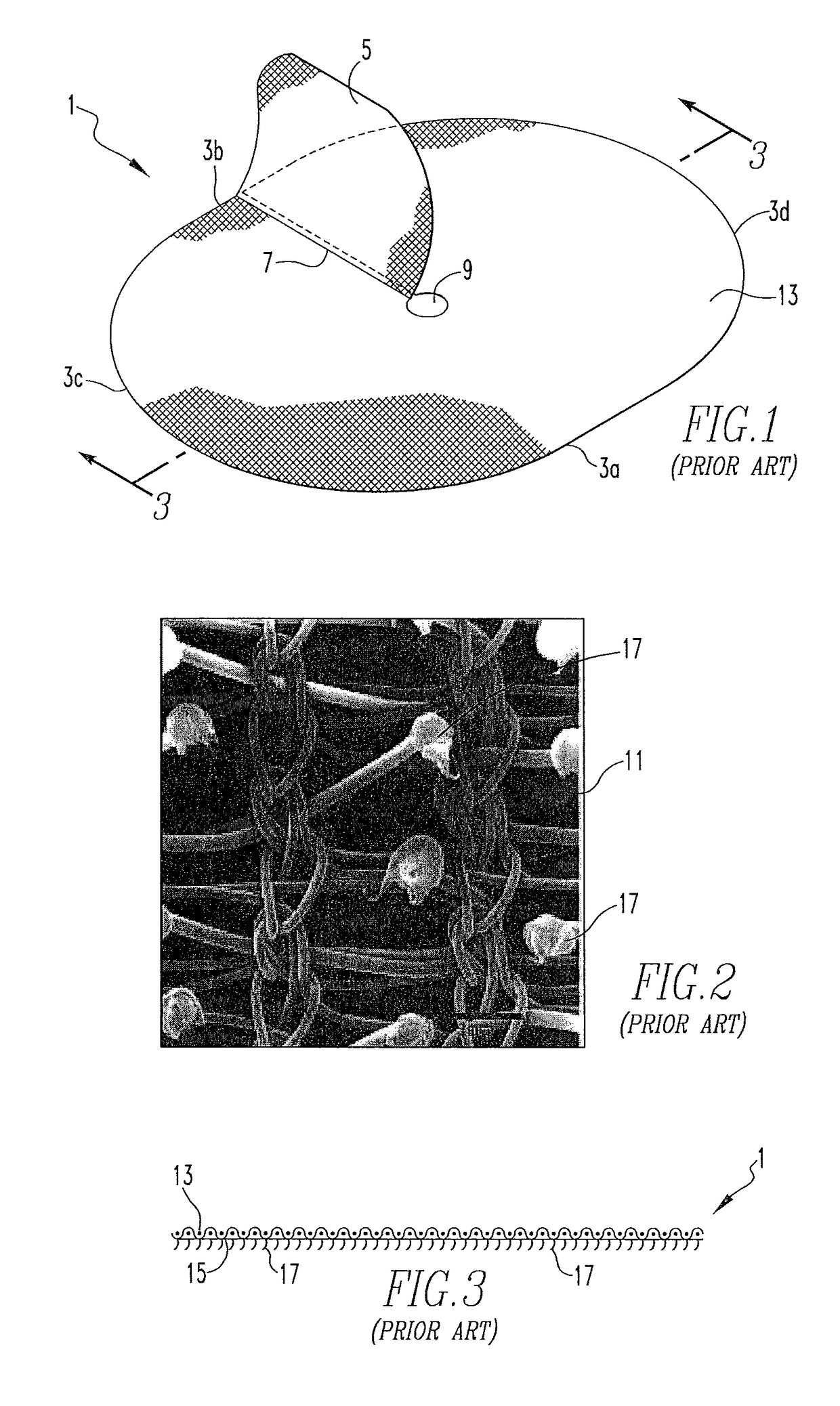 Surgical patch cover and method of use