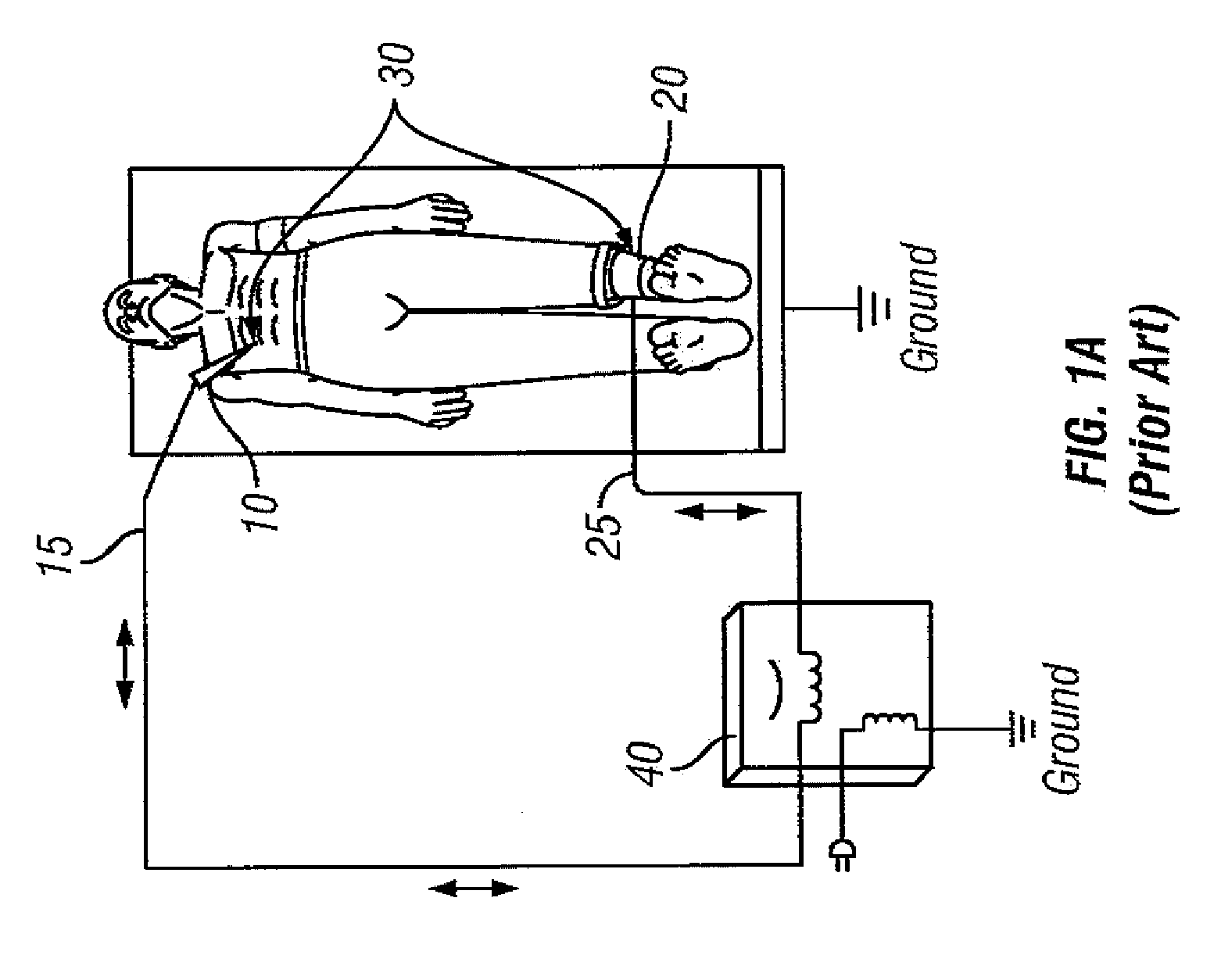 Connection of a bipolar electrosurgical hand piece to a monopolar output of an electrosurgical generator