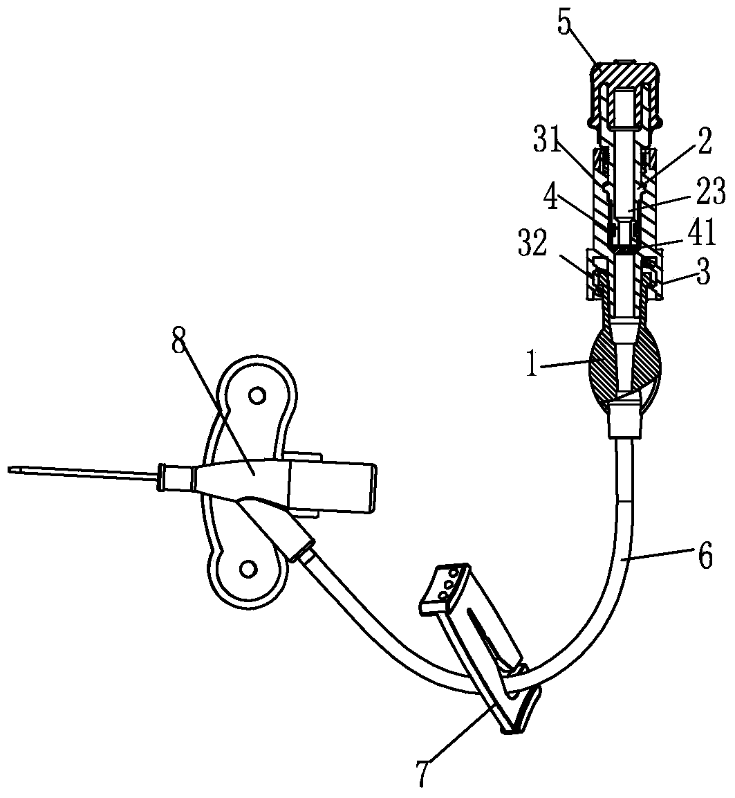 Medical infusion connector with shut-off valve connected to indwelling catheter outside the body