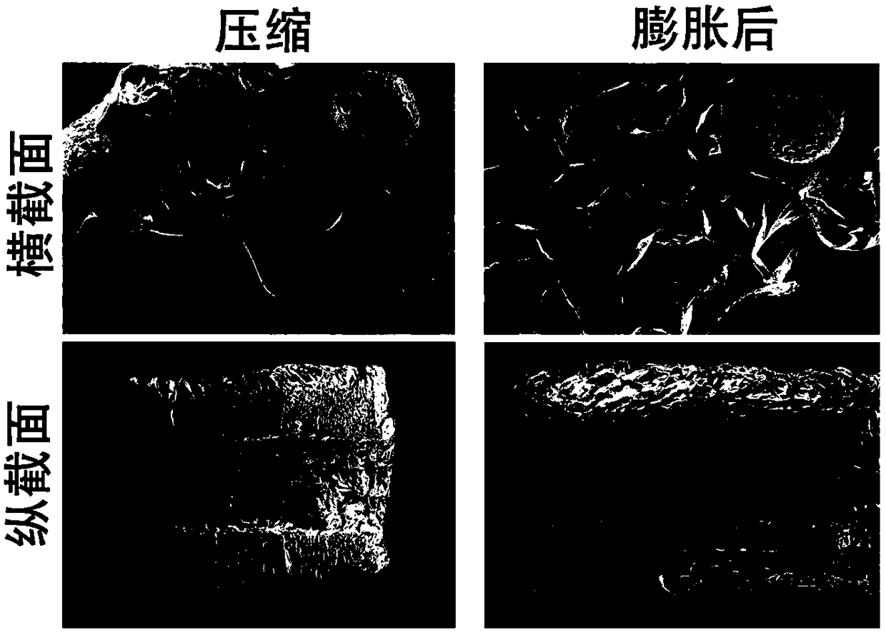 A kind of nerve-promoting repair tube and its preparation method and application