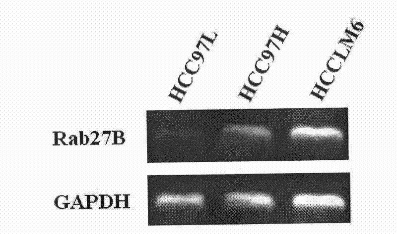 DNA fragment for peculiarly inhibiting Rab27B gene expression and application thereof