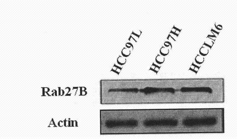 DNA fragment for peculiarly inhibiting Rab27B gene expression and application thereof