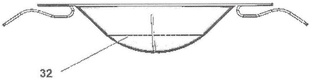 Cardiac valve support device fitted with valve leaflets