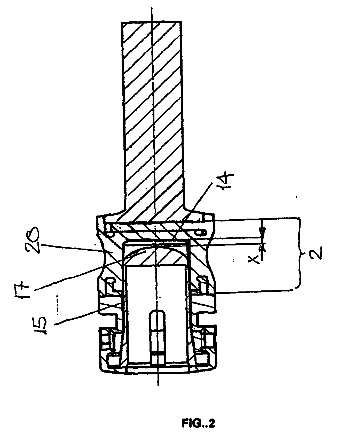 Dynamic damping element for two bones