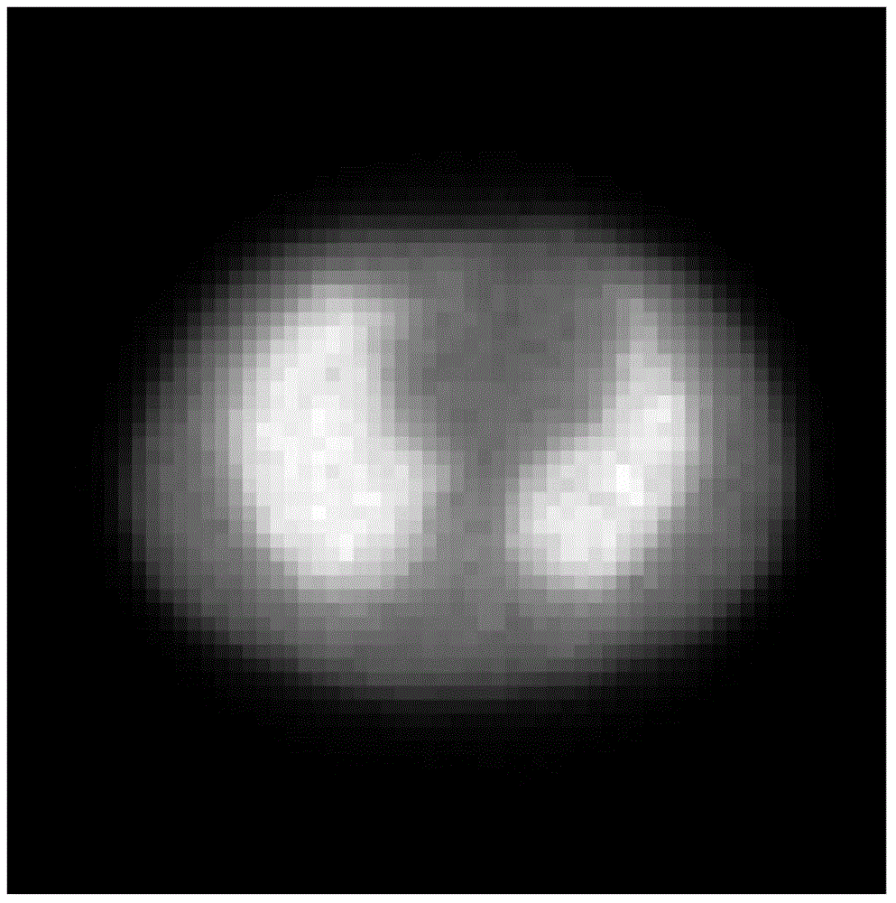 Dynamic PET (positron emission tomography) image reconstruction method based on Poisson TV