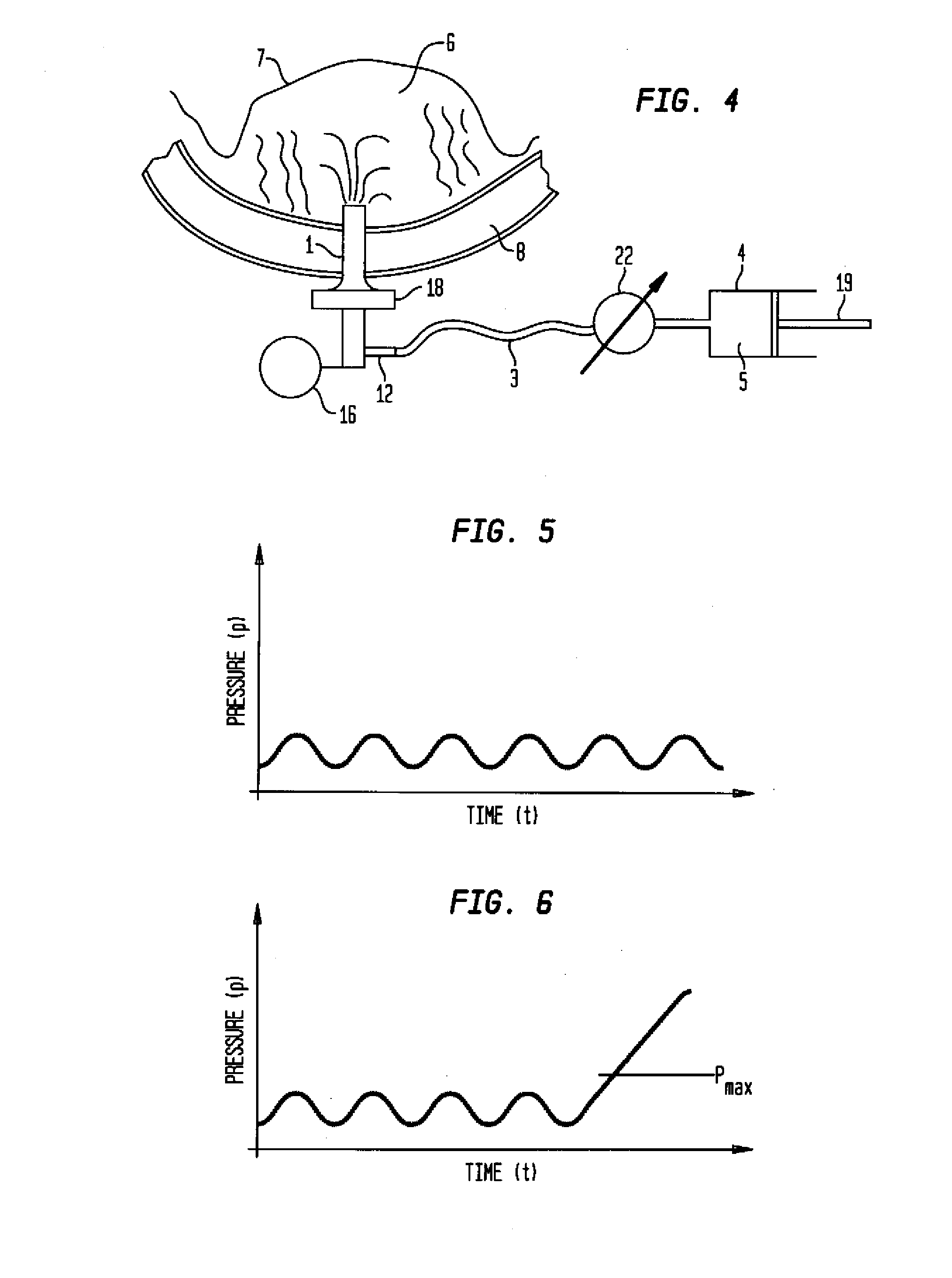 Surgical instrument and method for improving a crestal sinus lift
