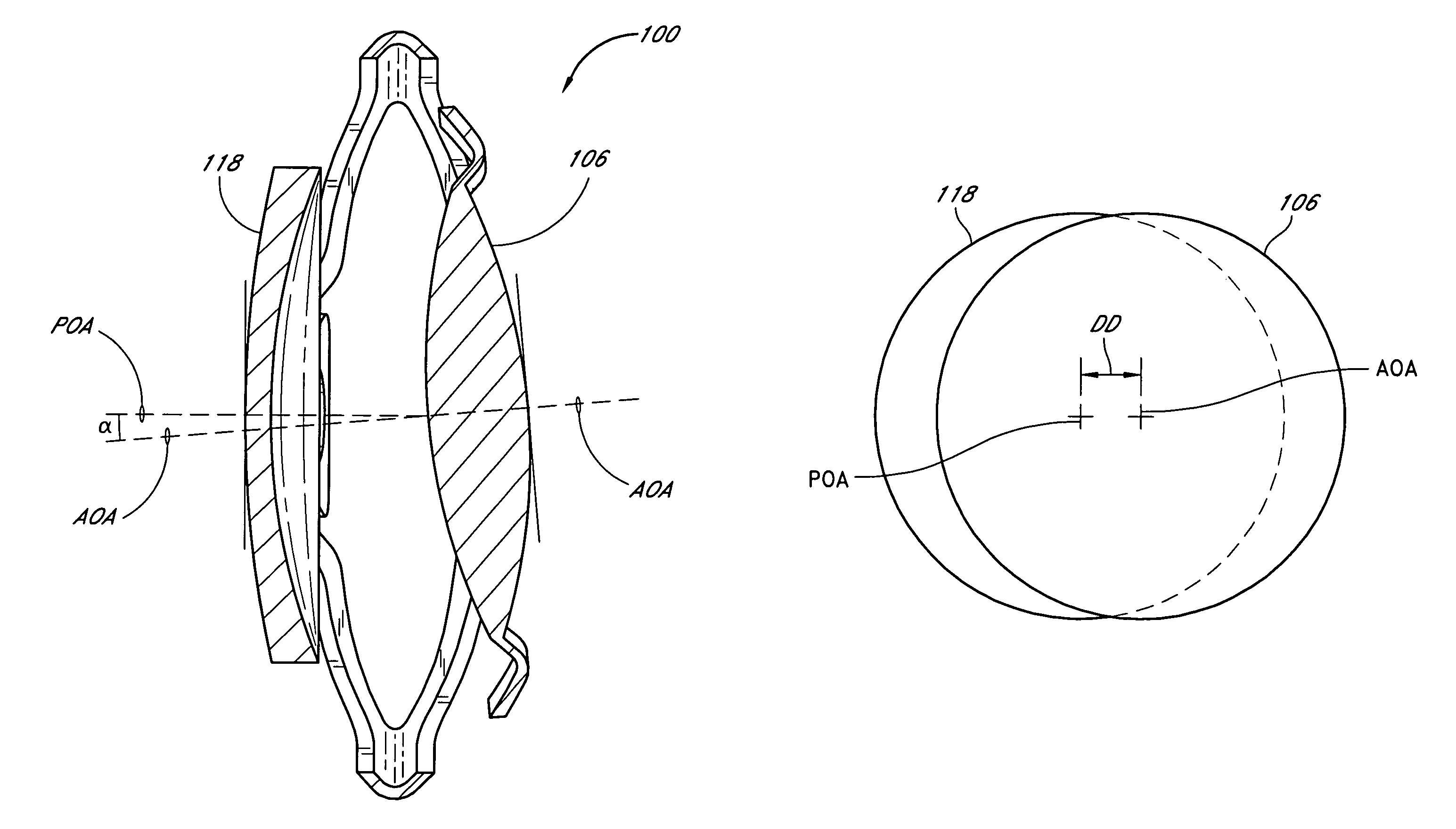 Accommodating intraocular lens system with aberration-enhanced performance