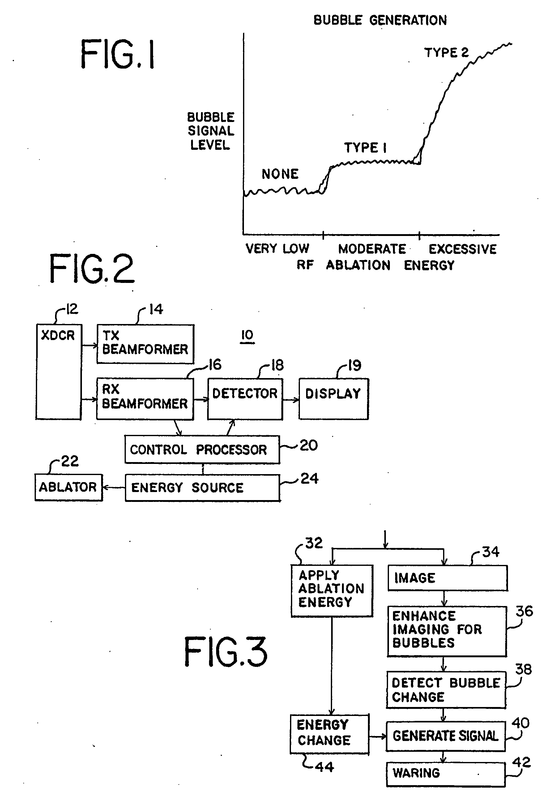 Ultrasound feedback for tissue ablation procedures