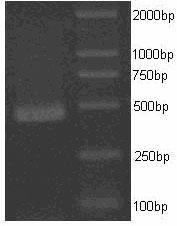 Bambusa emeiensis 'viridiflavus' chlorophyll degradation pathway related protein and encoding gene thereof as well as application of encoding gene