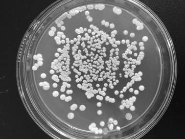 A kind of Streptomyces albicans x-18 and the method for producing ε-polylysine by using the bacterium