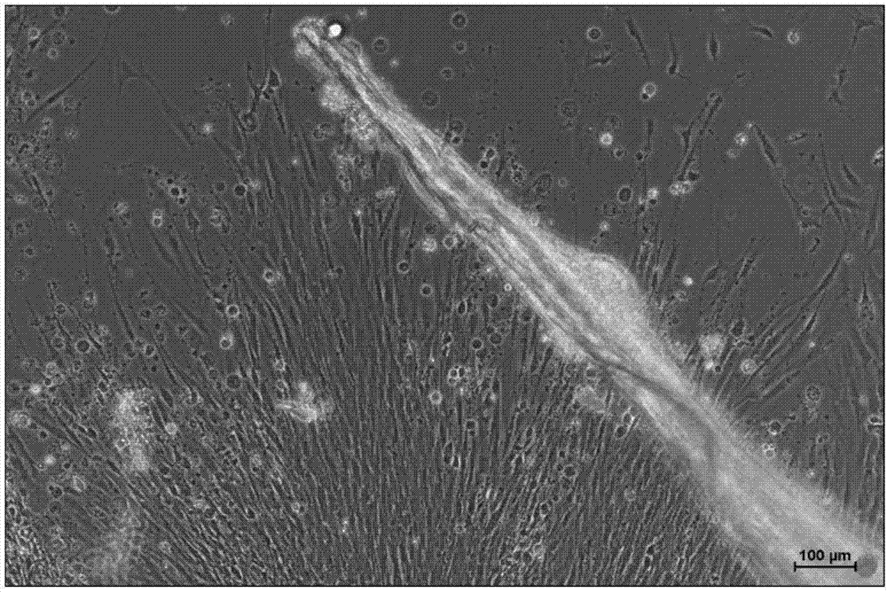 Megalobrama amblycephala bone tissue culture method