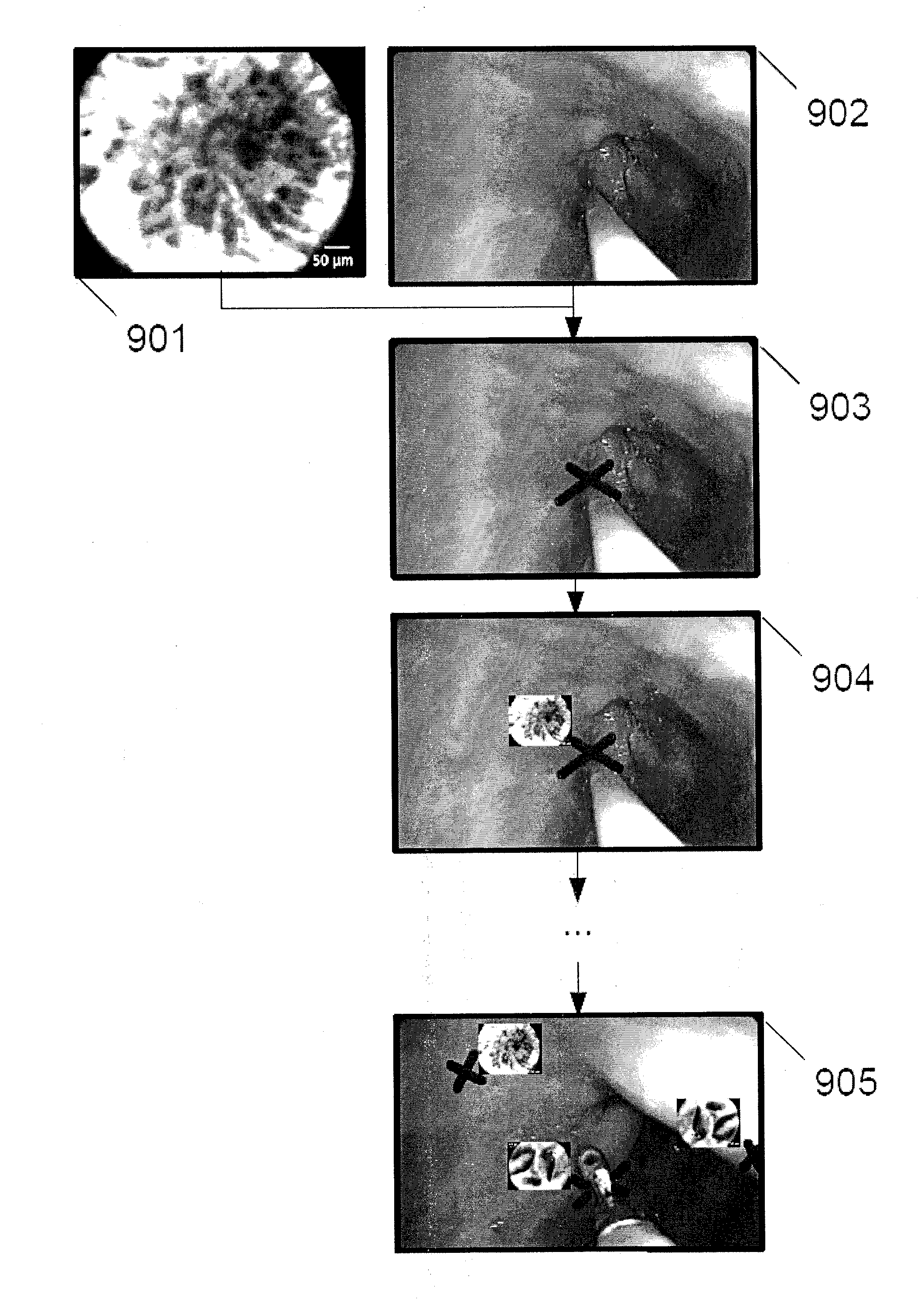 Method and system for processing images acquired in real time through a medical device