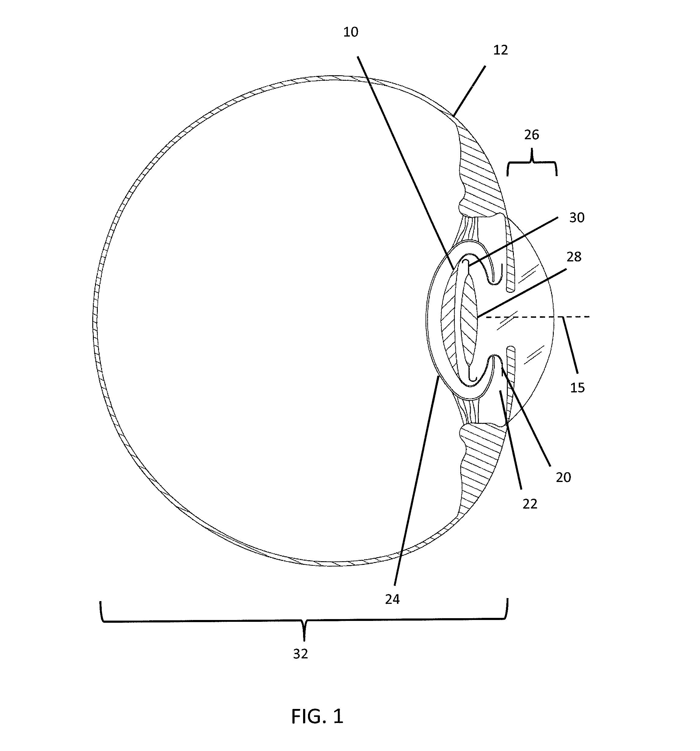 Prosthetic capsular bag and method of inserting the same