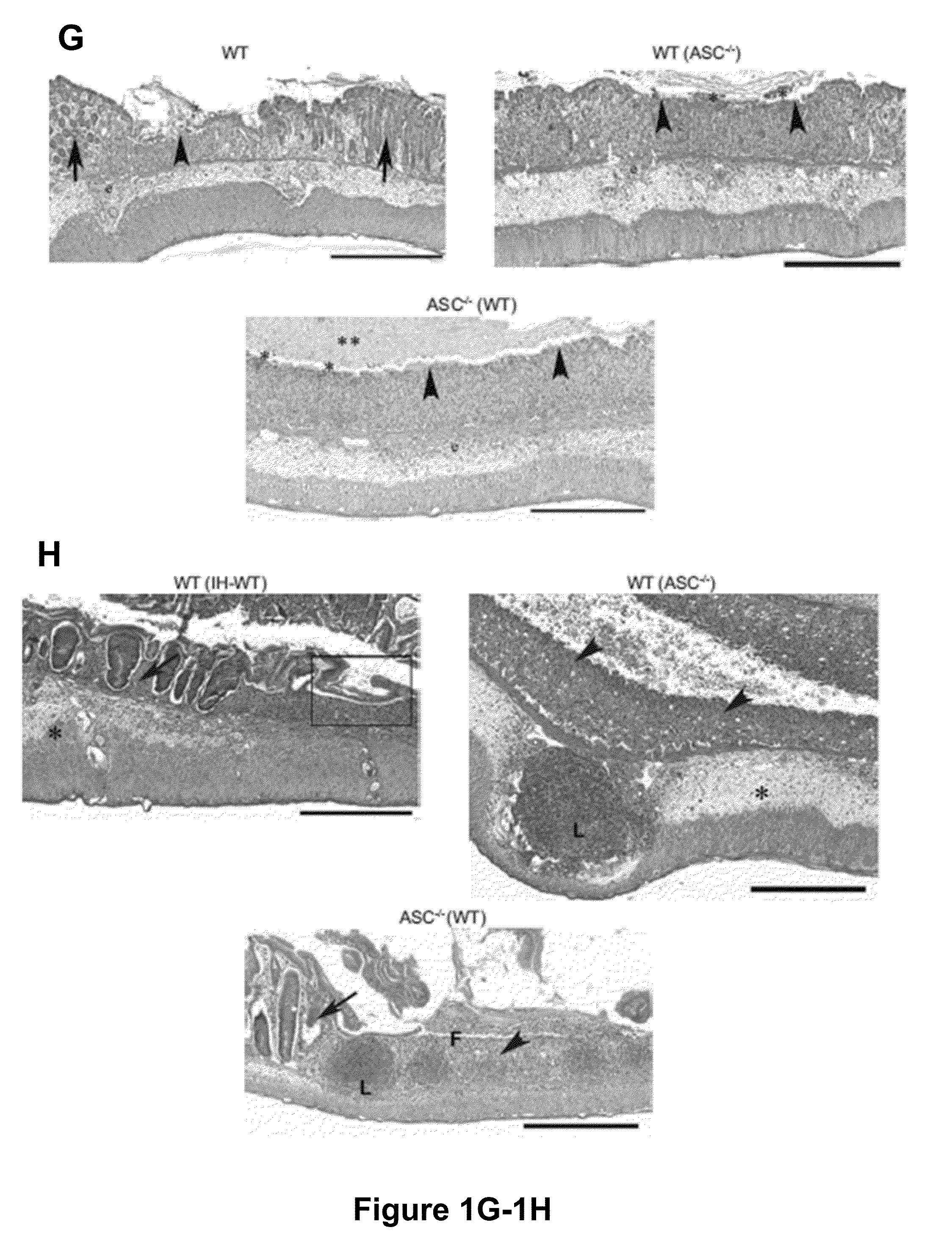 Compositions and Methods for Assessing and Treating Inflammatory Diseases and Disorders