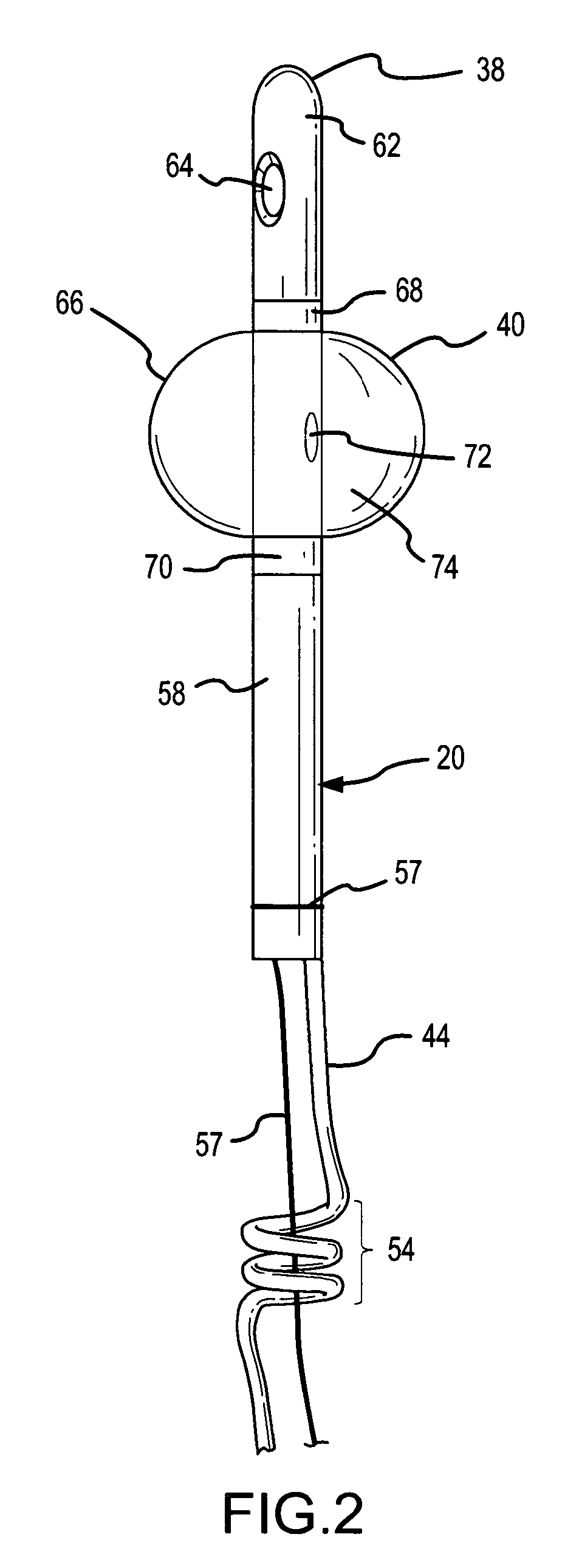 Partial-length indwelling urinary catheter and method permitting selective urine discharge