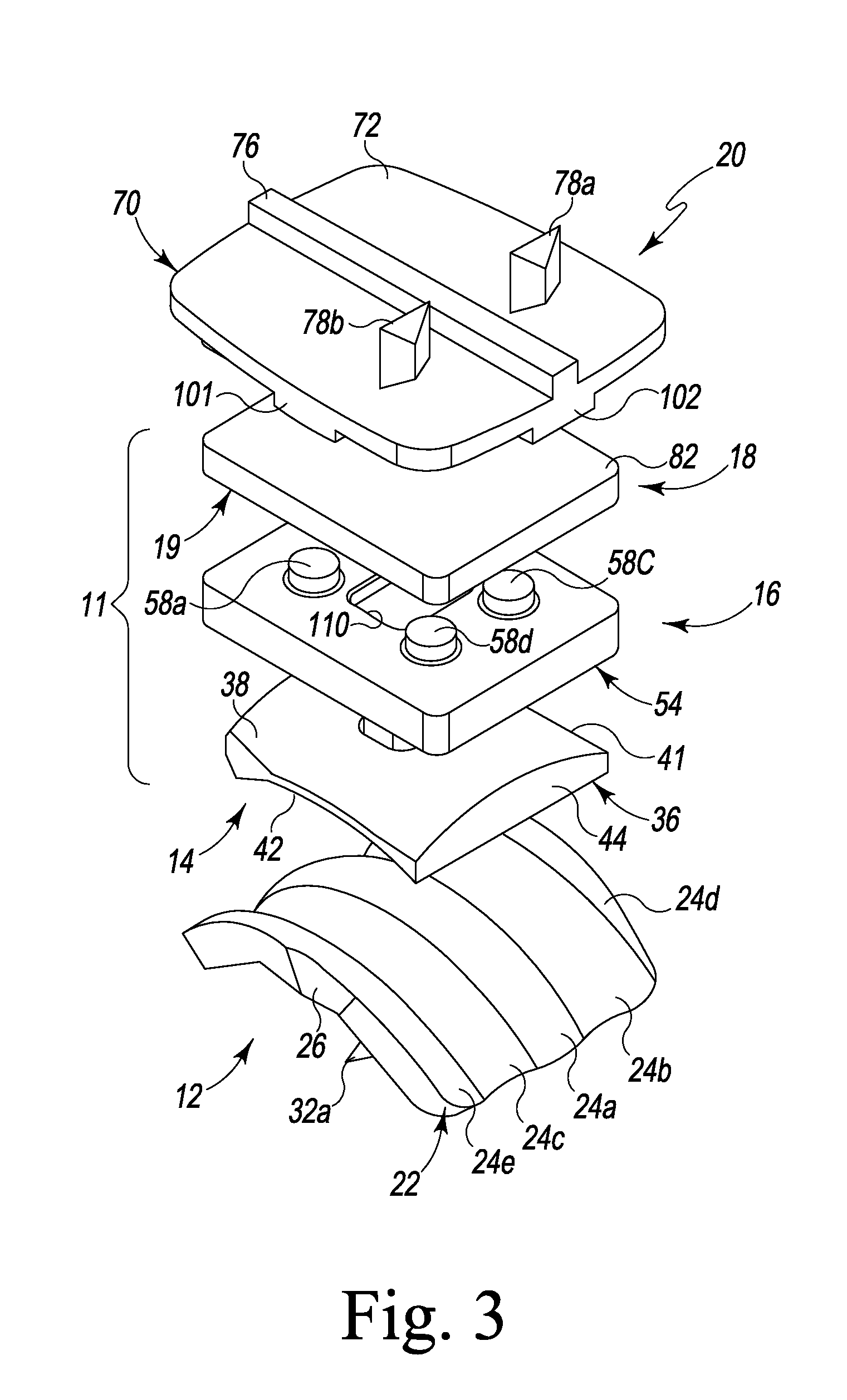 Semi Constrained Polyaxial Endoprosthetic Ankle Joint Replacement Implant