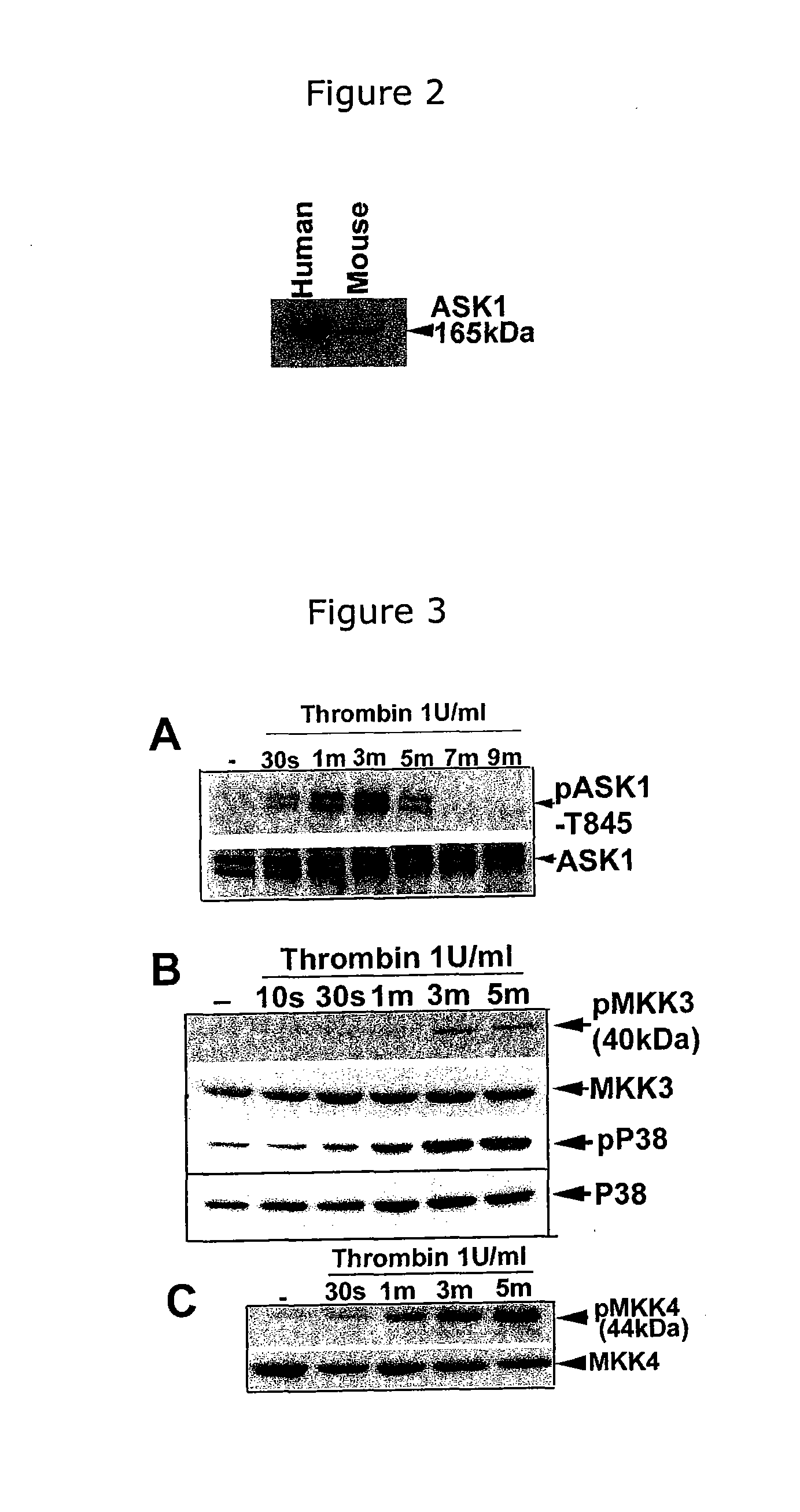 Methods of treating and preventing thrombotic diseases using ask1 inhibitors