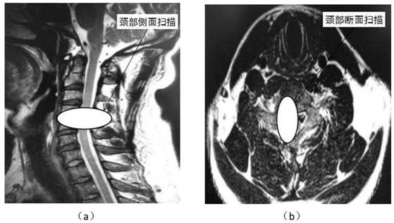Ganglion block treatment training model for pain medical clinical practical training and control method thereof