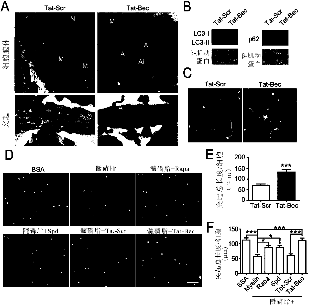 Application of autophagy inducer serving as microtubule stabilizing drug to promotion of nerve regeneration