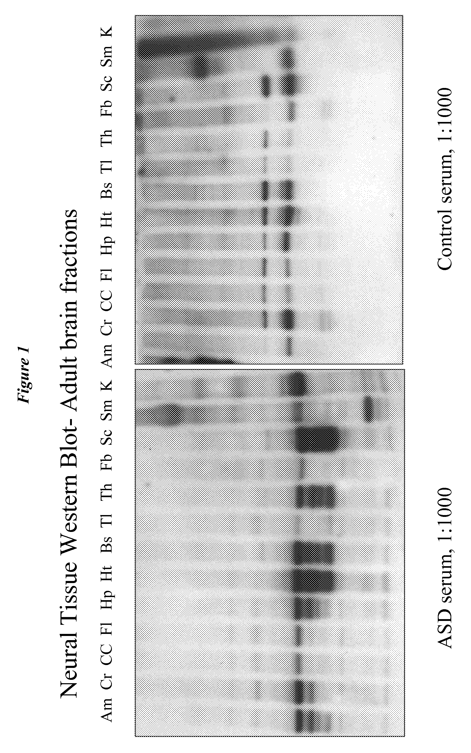 Diagnostic methods for the detection of risk of neurodevelopmental disorders