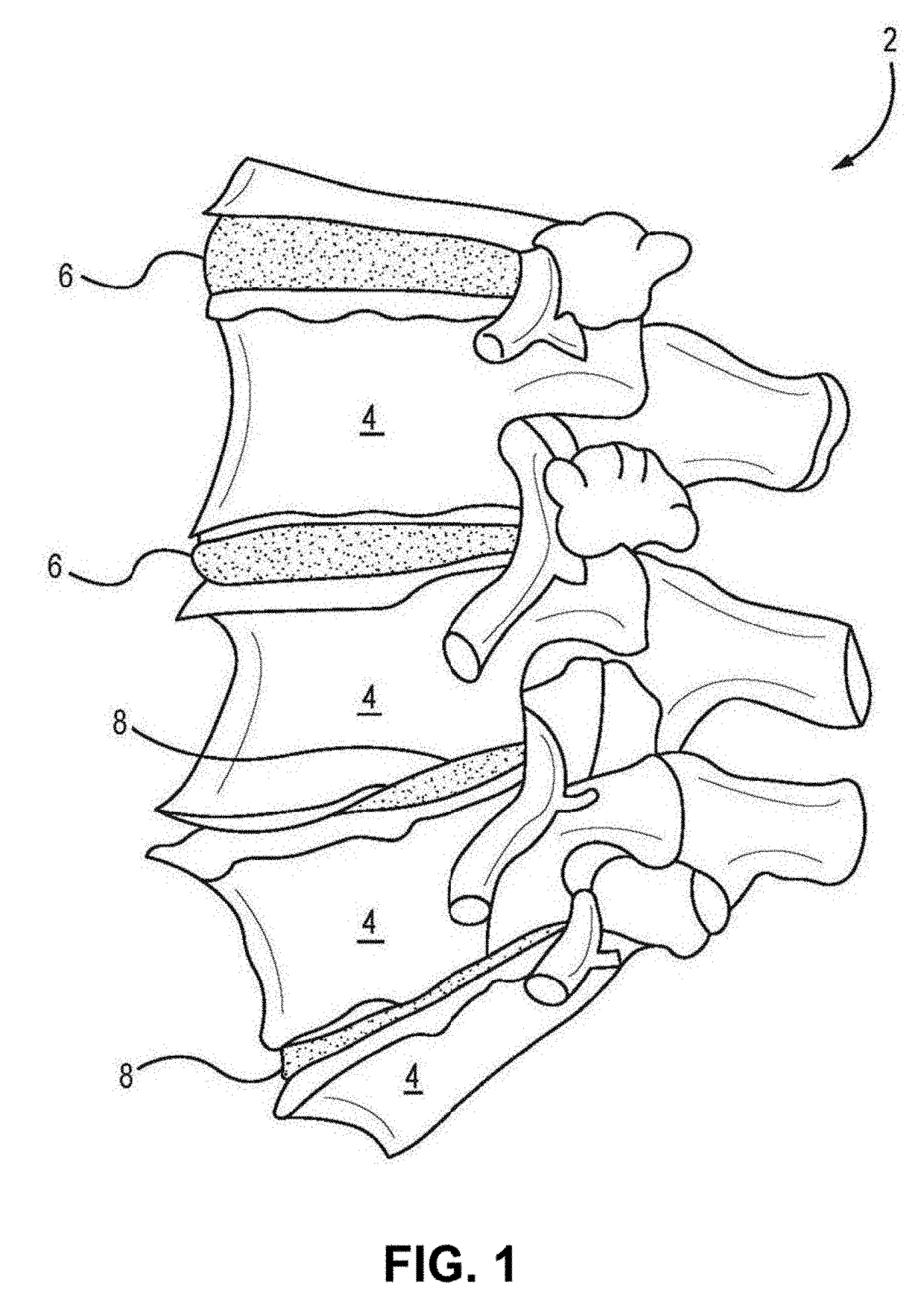 Acif cage, cage system and method