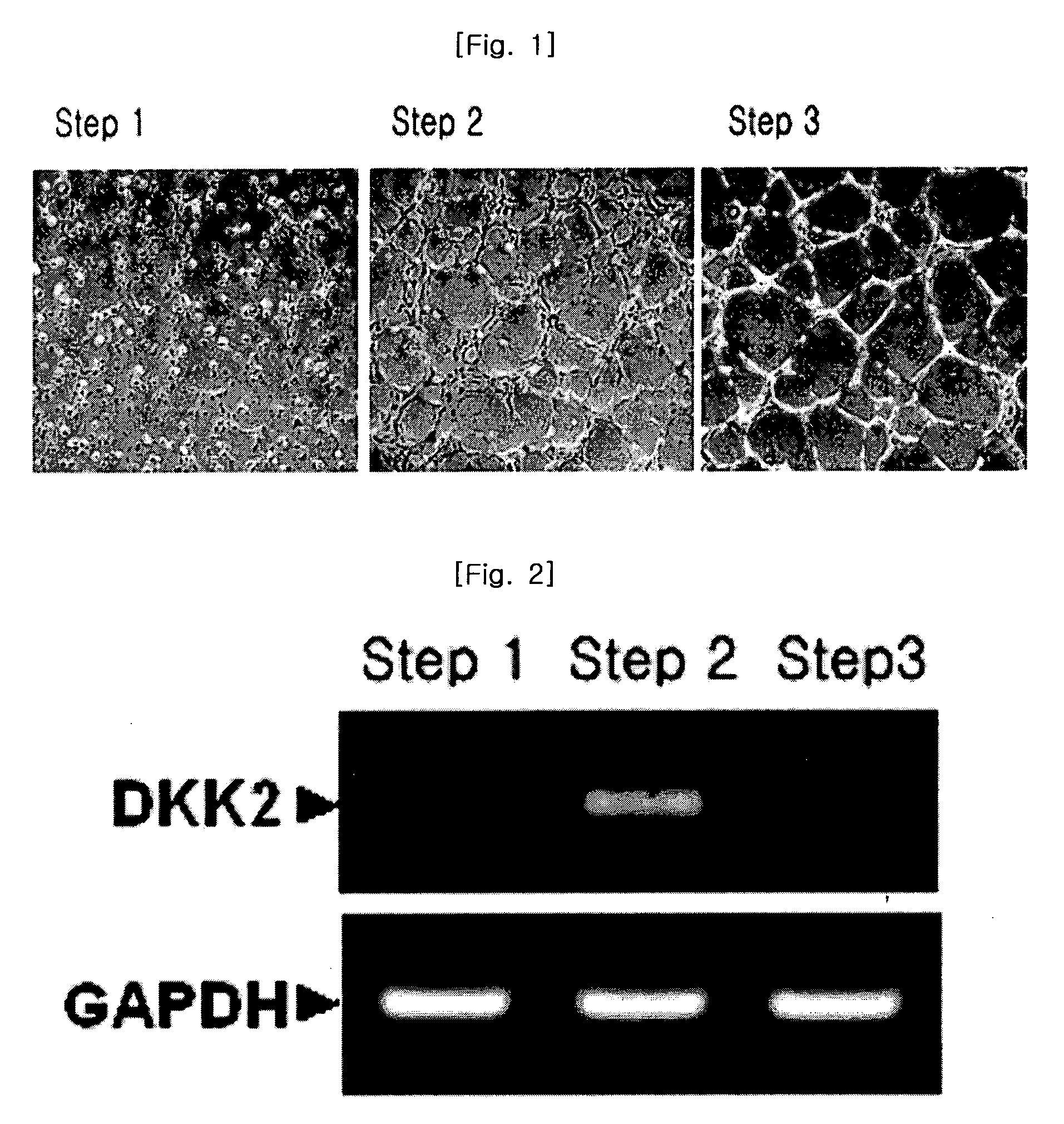 Method for stimulating angiogenesis using dkk2 and composition comprising the same