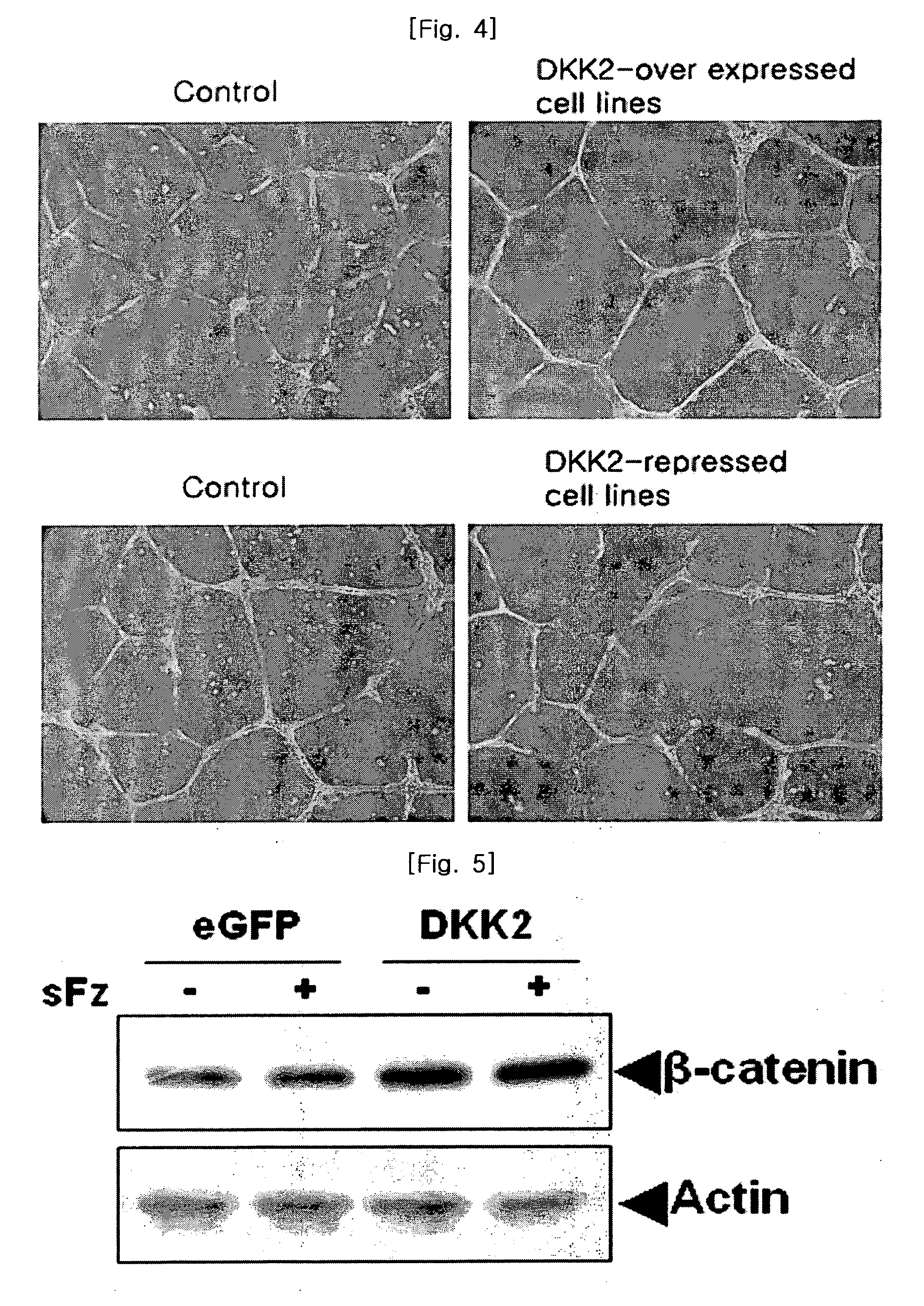 Method for stimulating angiogenesis using dkk2 and composition comprising the same