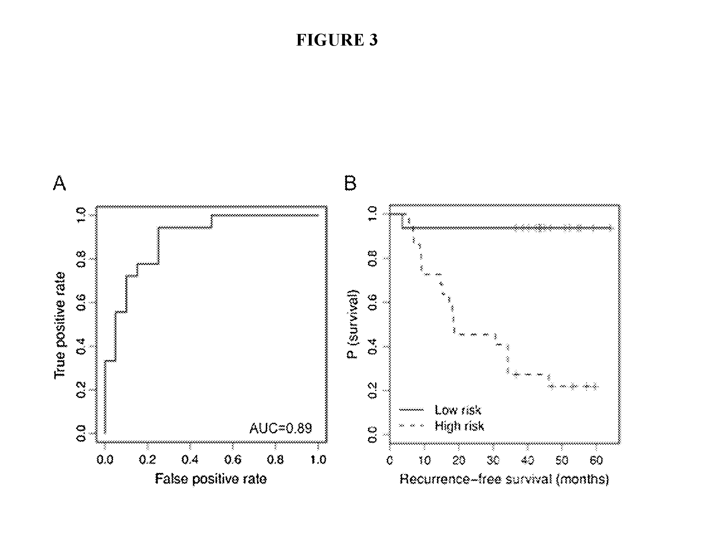 Sera Based miRNAs as Non-Invasive Biomarkers in Melanoma