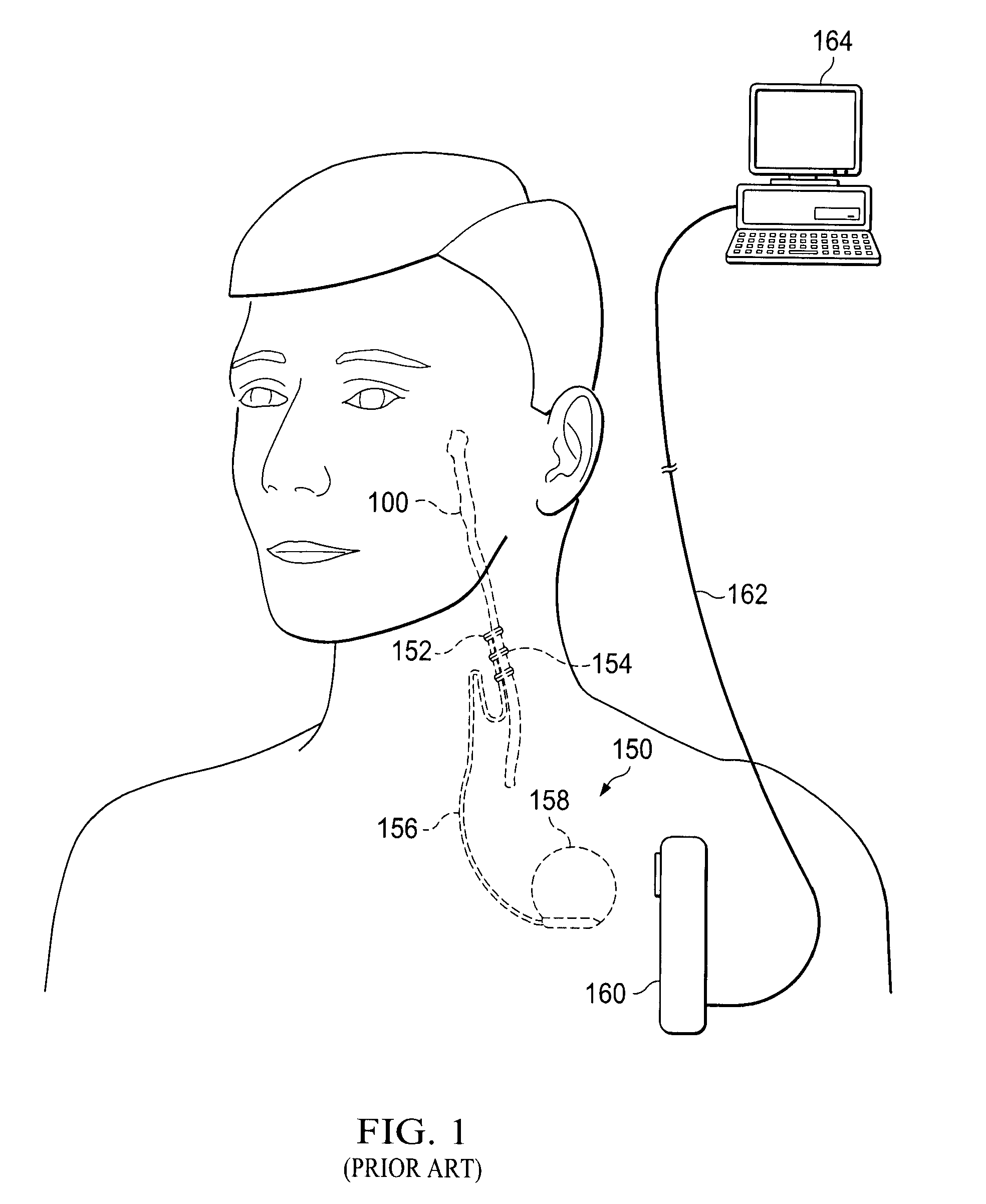 Devices and Methods for Screening of Vagal Nerve Stimulation