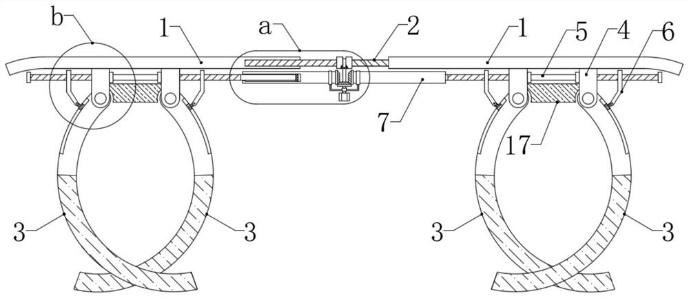 Extravascular stent for kidney transplantation