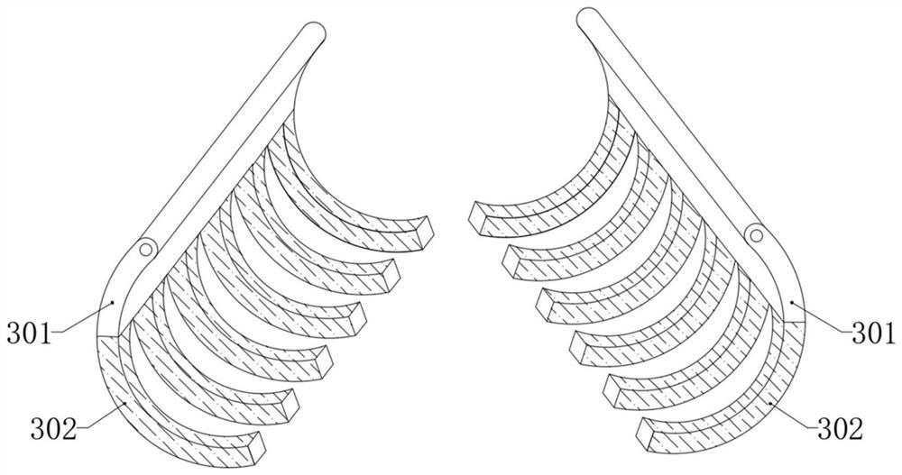 Extravascular stent for kidney transplantation