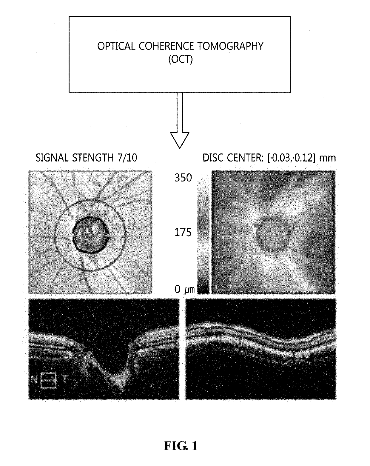 Glaucoma diagnosis method using fundus image and apparatus for the same