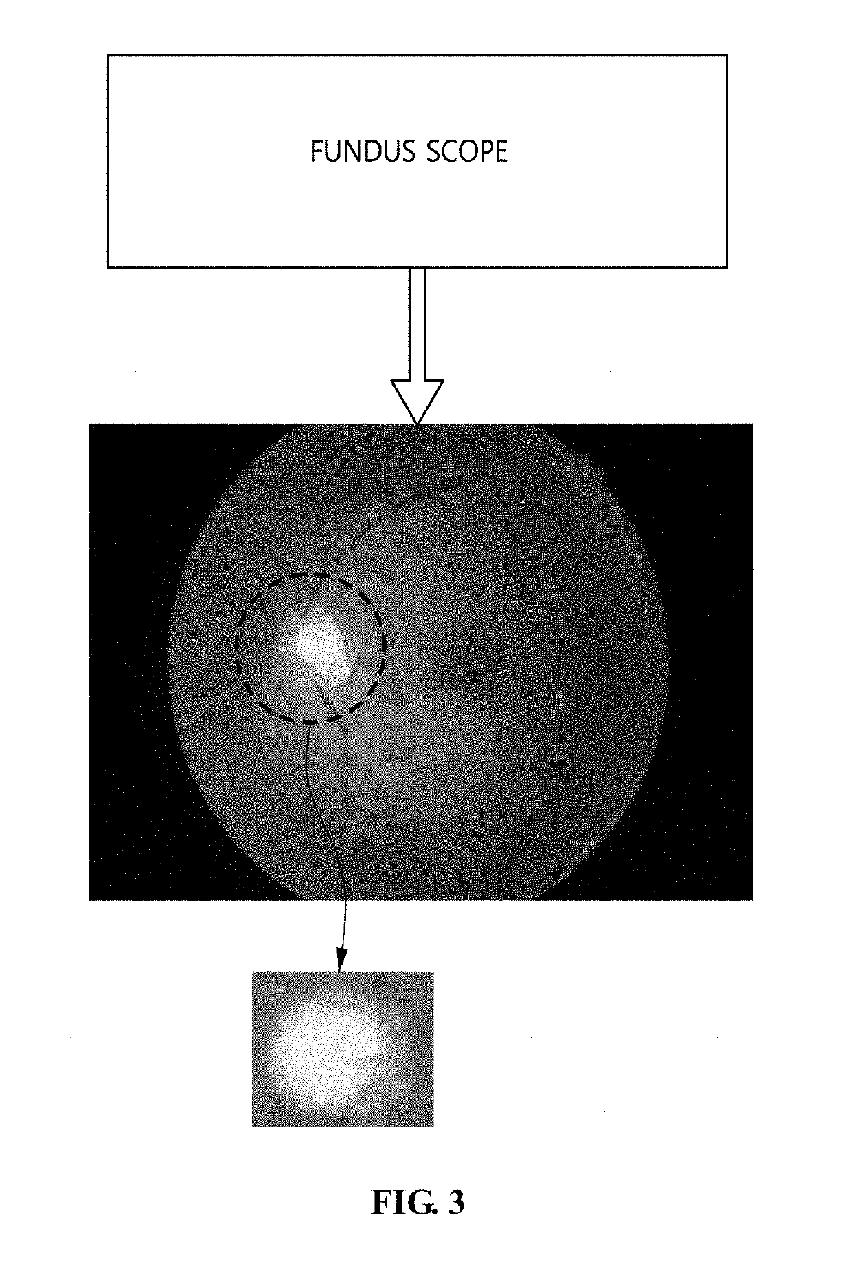 Glaucoma diagnosis method using fundus image and apparatus for the same