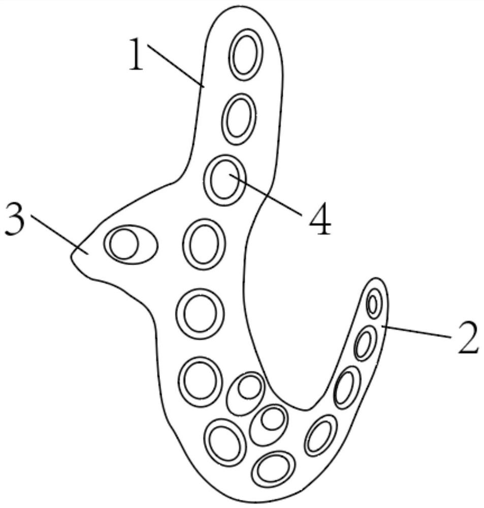 Hoffa anatomical steel plate